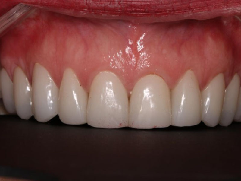 estetica-dental-3