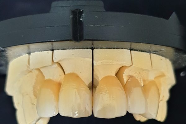 ZIRCONIO 3D 4D