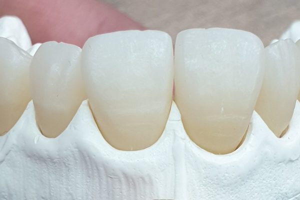 ZIRCONIO 3D 4D
