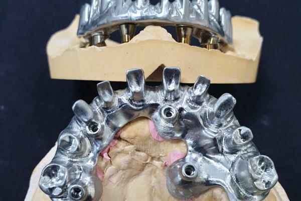 implantes cigomaticos