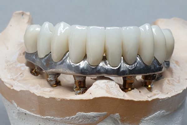 titanio zirconio