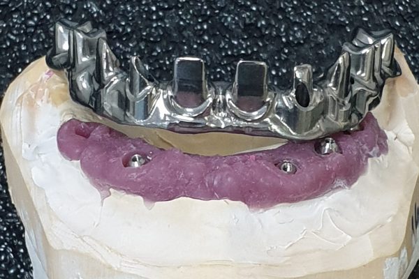 titanio zirconio