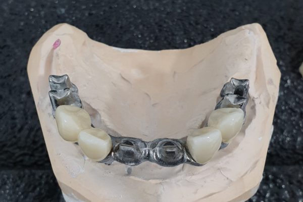 titanio zirconio