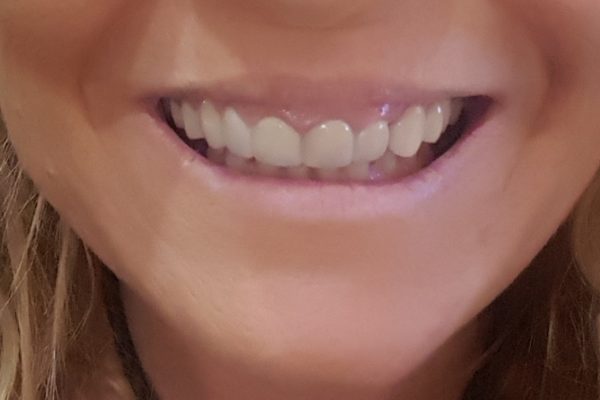 DISILICATO