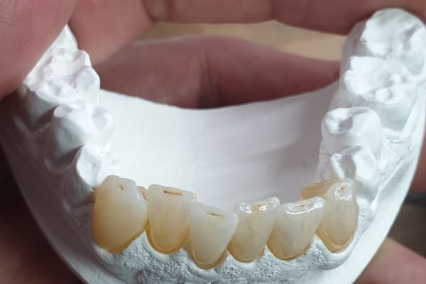 zirconio ht ml