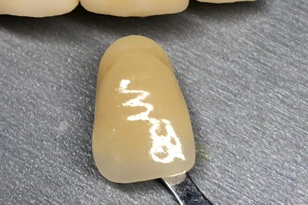 PERSONALIZACION DE PROTESIS