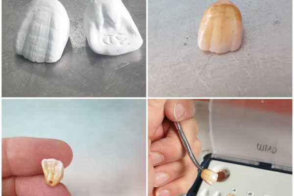ZIRCONIO 3D 4D