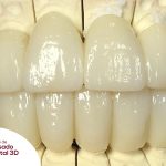 prótesis dental